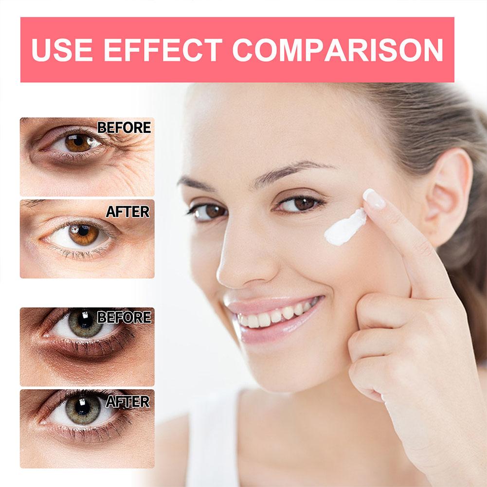 Retinol Eye Cream Lightening D - đánh giá và giá The Ordinary Serum Hyaluronic Acid